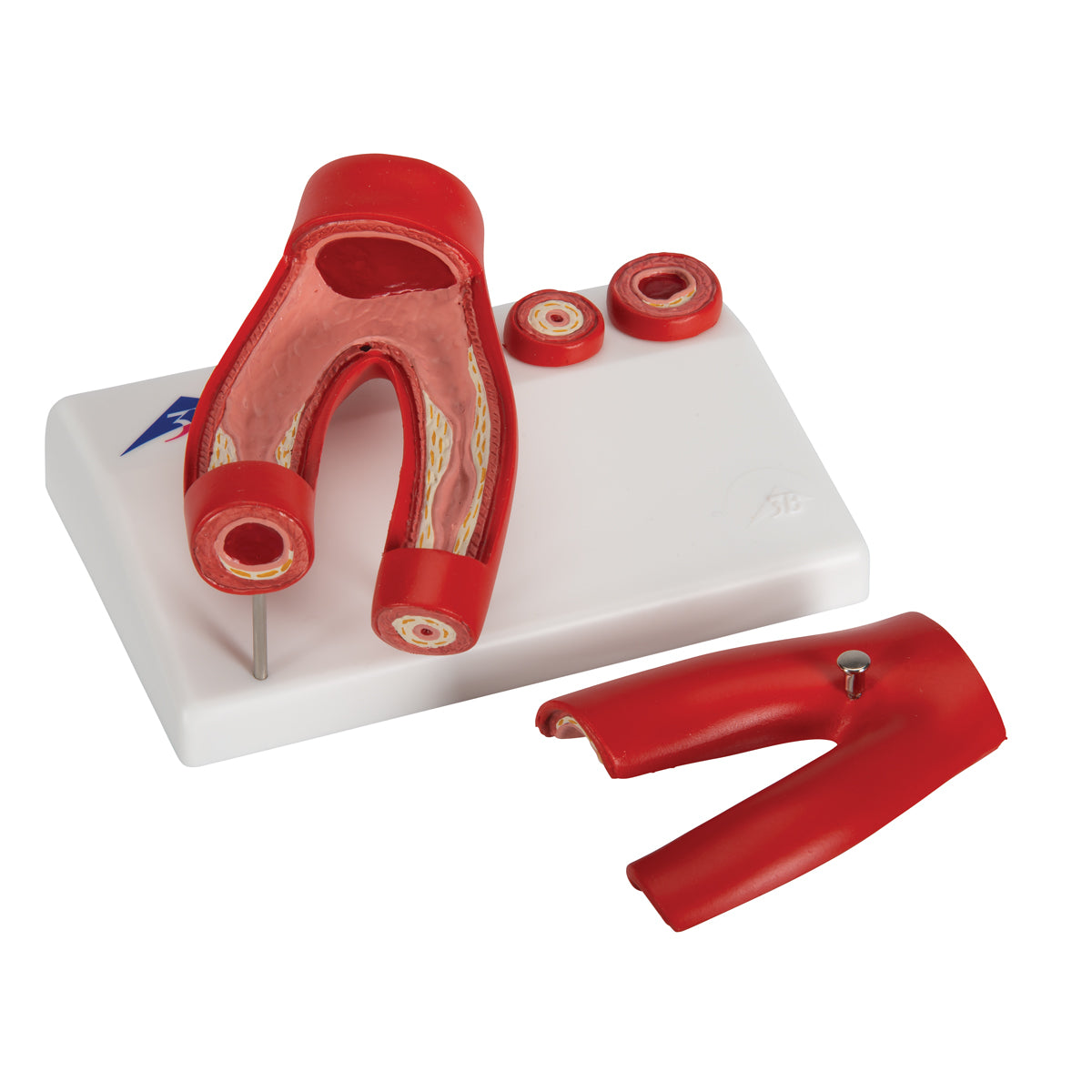 3B Scientific arteriosclerosis model with artery cross section