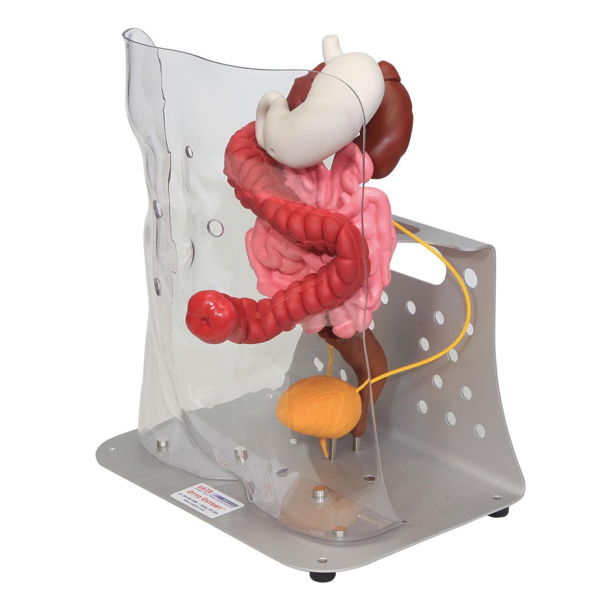 Otto Ostomy™ Advanced Model by 3B Scientific showing a realistic medical training device with detailed ostomy features.