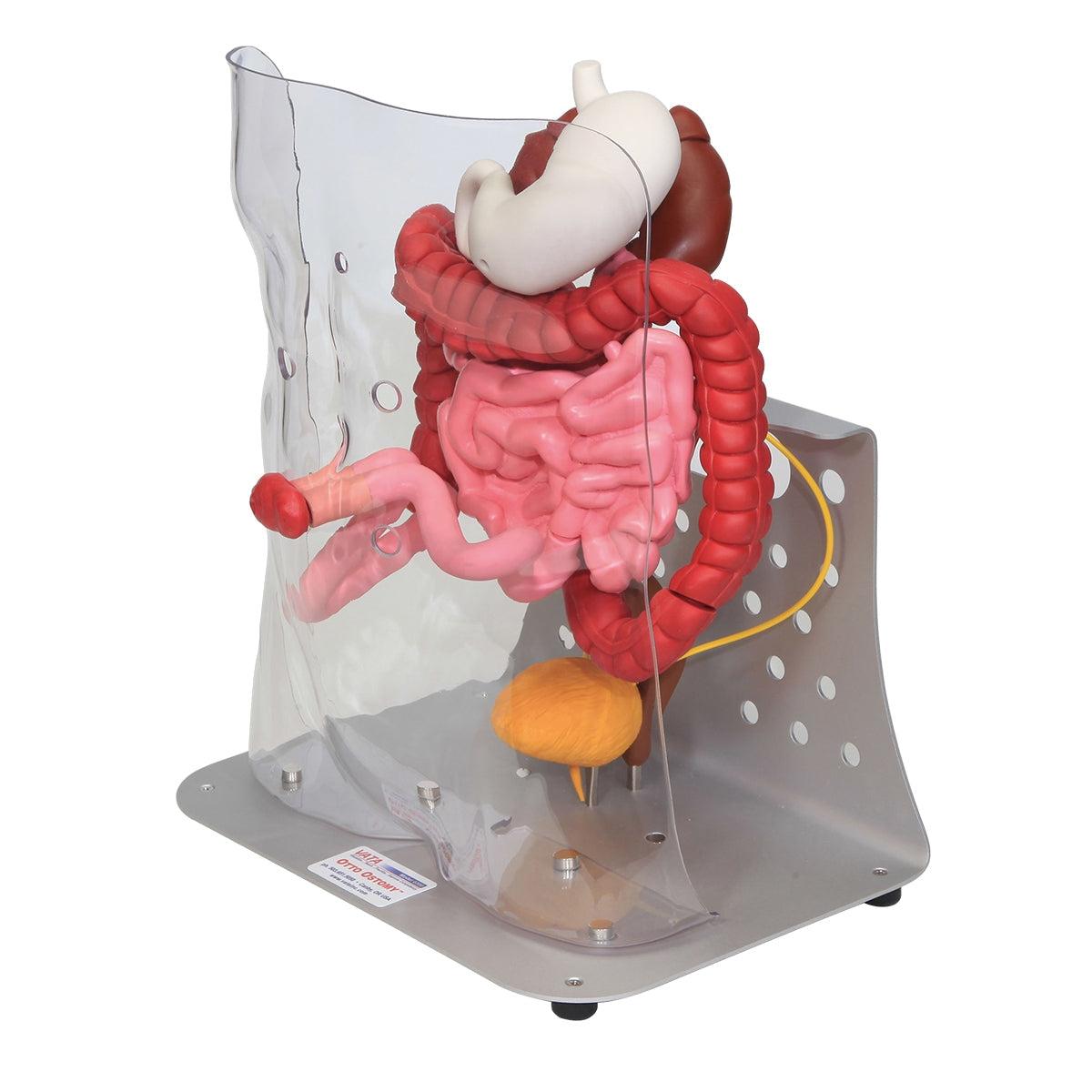 Otto Ostomy™ Advanced Model by 3B Scientific demonstrating the realistic anatomy of an ostomy site and stoma.