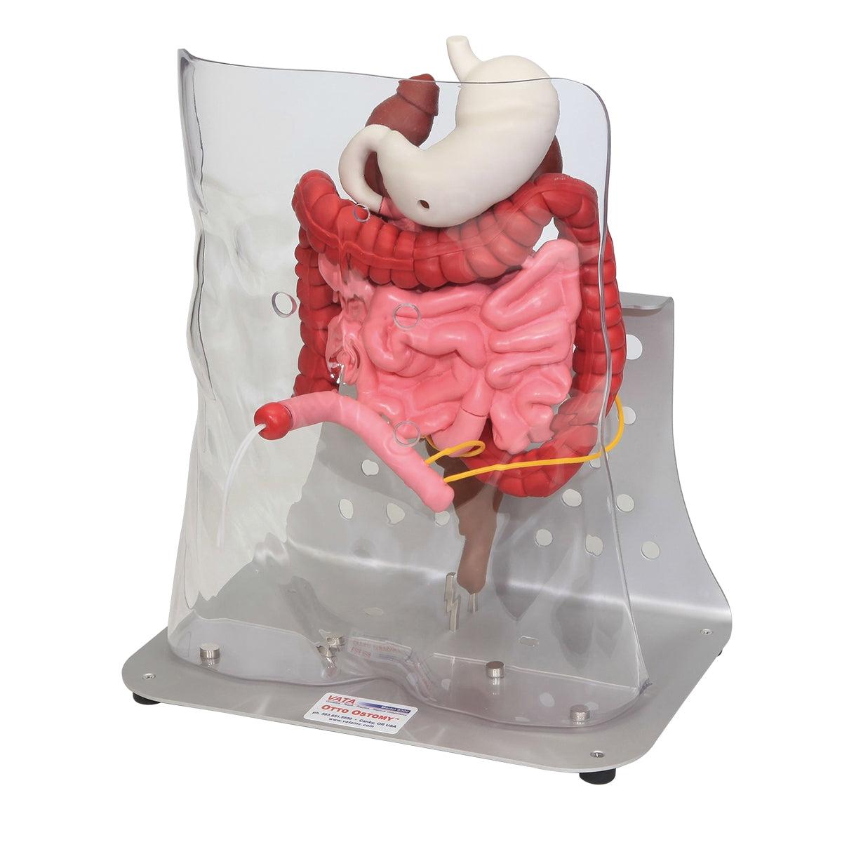 Otto Ostomy™ Advanced Model by 3B Scientific showing detailed medical ostomy simulation with realistic features and components.