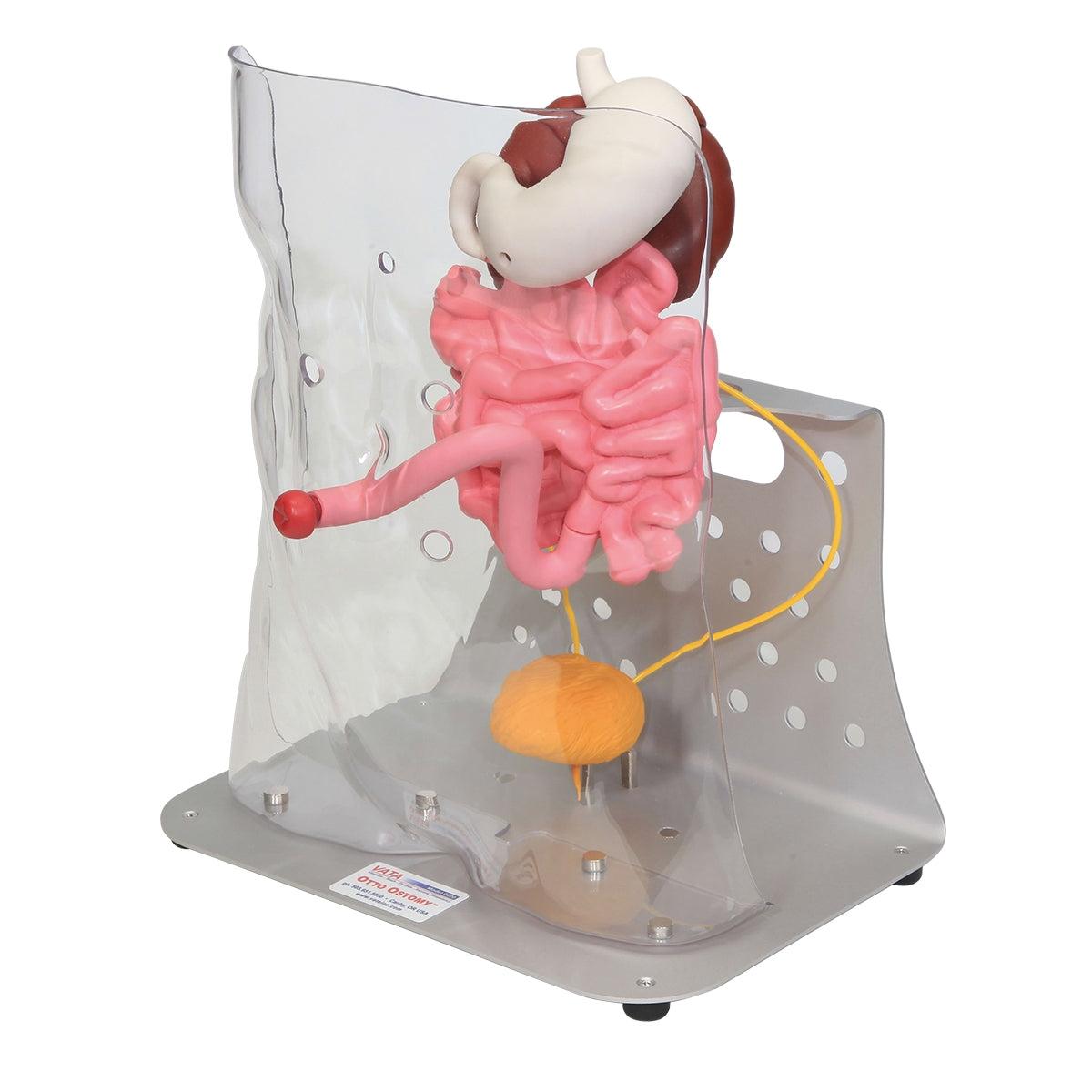 Otto Ostomy™ Advanced Model by 3B Scientific, realistic medical training model showing ostomy site and abdominal features.