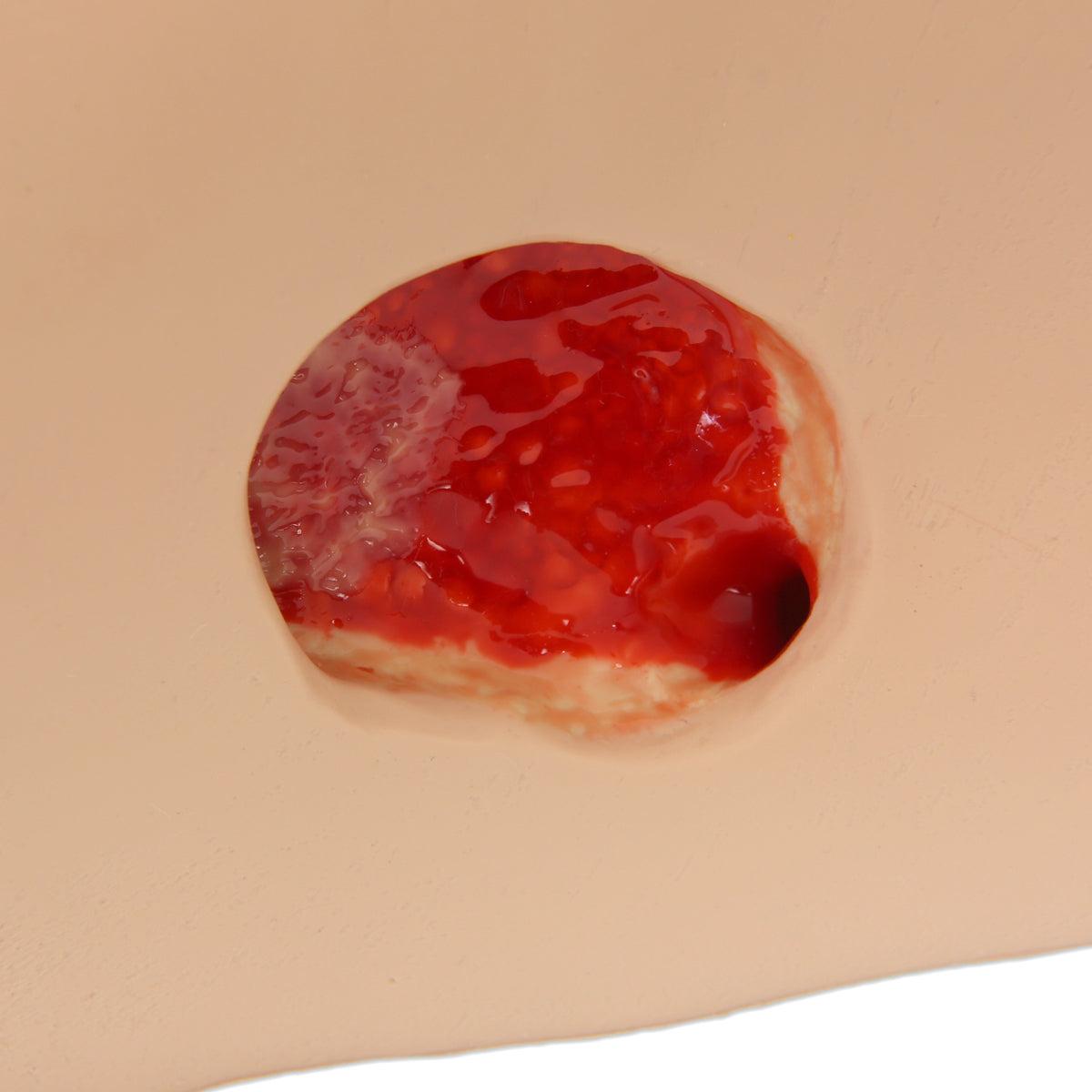 3B Scientific Seymour II™ Wound Care Simulator demonstrating realistic wound and skin textures for medical training practice.