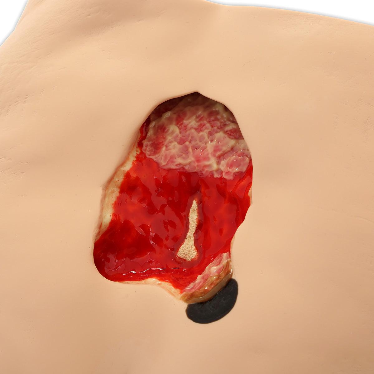 3B Scientific Seymour II™ Wound Care Simulator showing detailed realistic wound models for medical training practice.