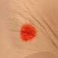 3B Scientific Seymour II™ wound care simulator showing realistic skin and wound details for medical training practice