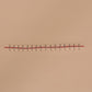 Stapled Incision Wound Board, light