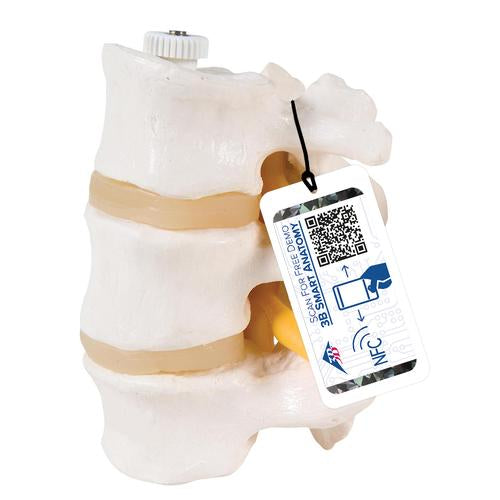 3B Scientific flexibly mounted lumbar vertebrae model