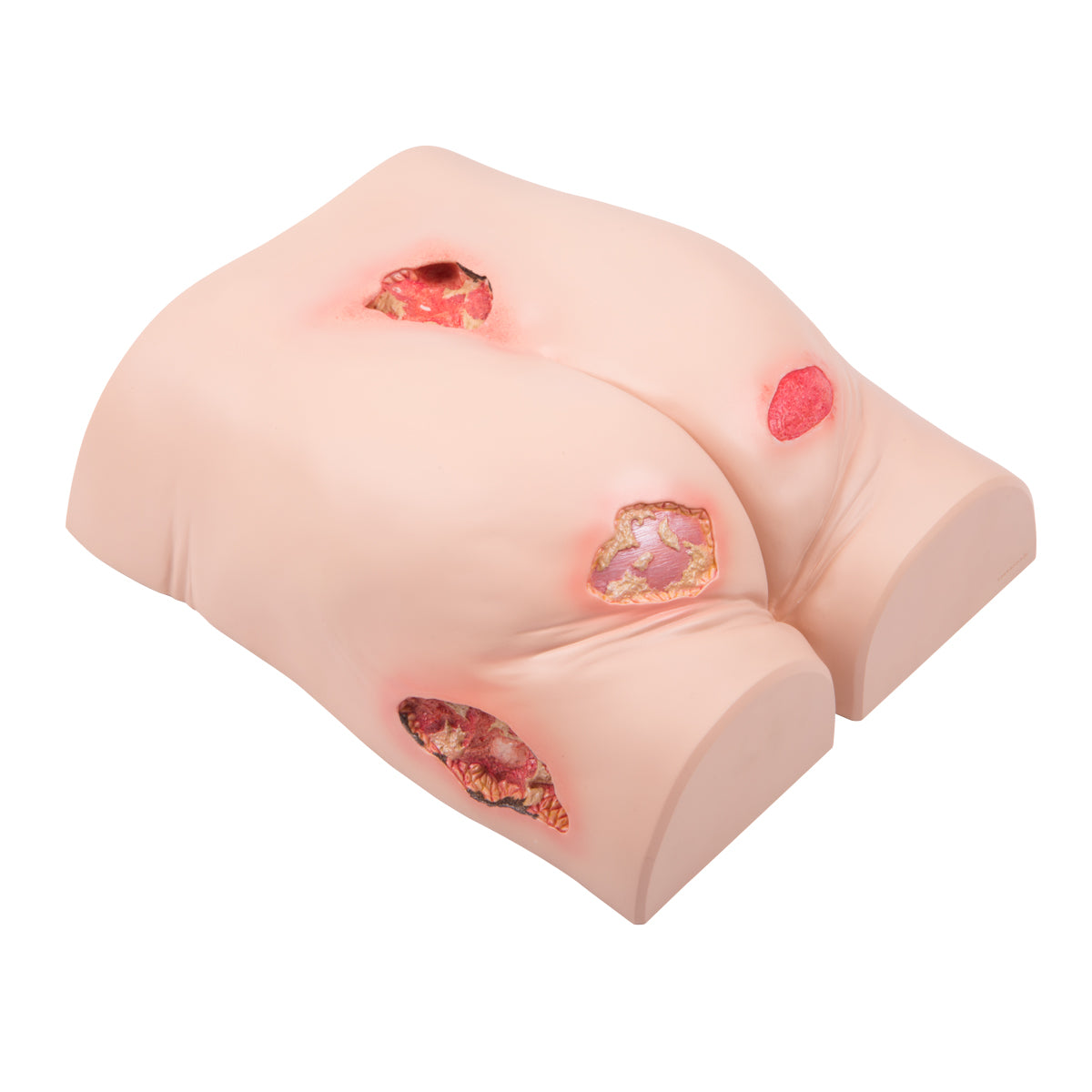 3B Scientific decubitus pressure ulcer trainer
