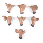 7 Uteri - Normal and with External Pathologies