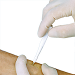 Acu Punch 4mm Biopsy Punches - Box of 10