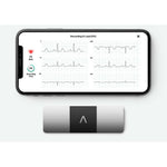 AliveCor KardiaMobile ECG 6 Lead