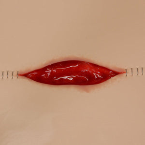 Dehisced Wound Board, light