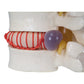 Herniated Disc Simulator
