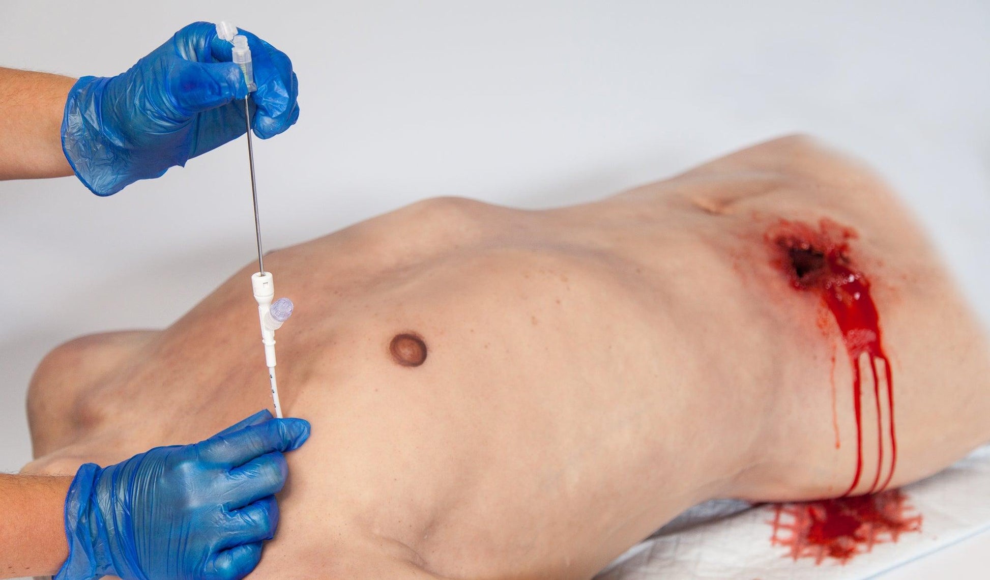 Russell PneumoFix Veress Tipped Needle - Long - 11cm