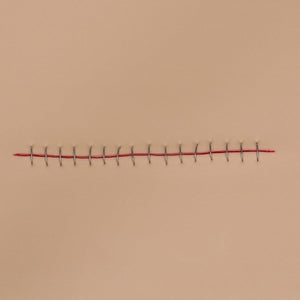 Stapled Incision Wound Board, light