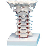 Erler Zimmer cervical vertebral column with stand