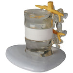 Erler Zimmer herniated disc simulator