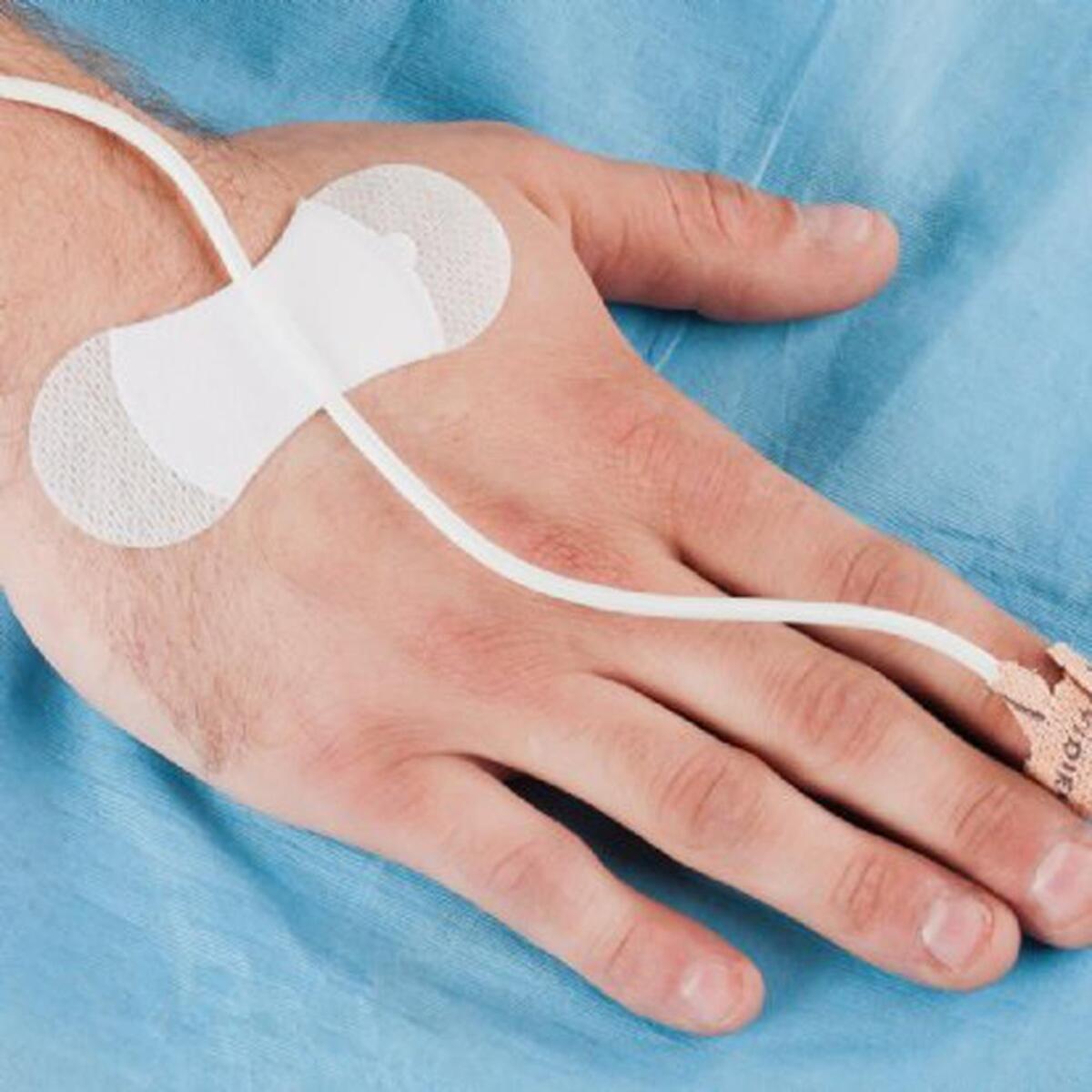 Pack of 100 Grip-Lok securement devices for catheter and tube stabilization dressing, designed to keep medical tubes securely in place.