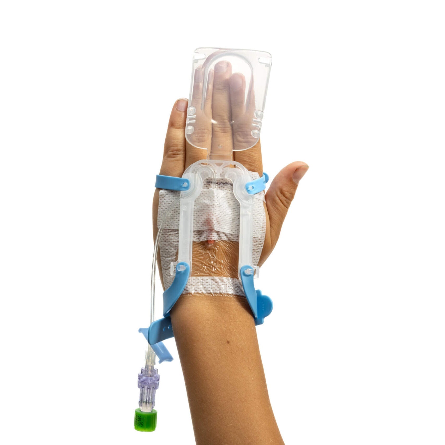 Pediatric IV Glove 3.0 securement device by IV Glove, pack of 25, shown securing IV catheter on child's arm.