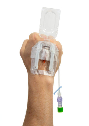 IV Glove 3.0 strapless open and closed-hand image showing secure, skin-friendly IV securement gloves for medical use.