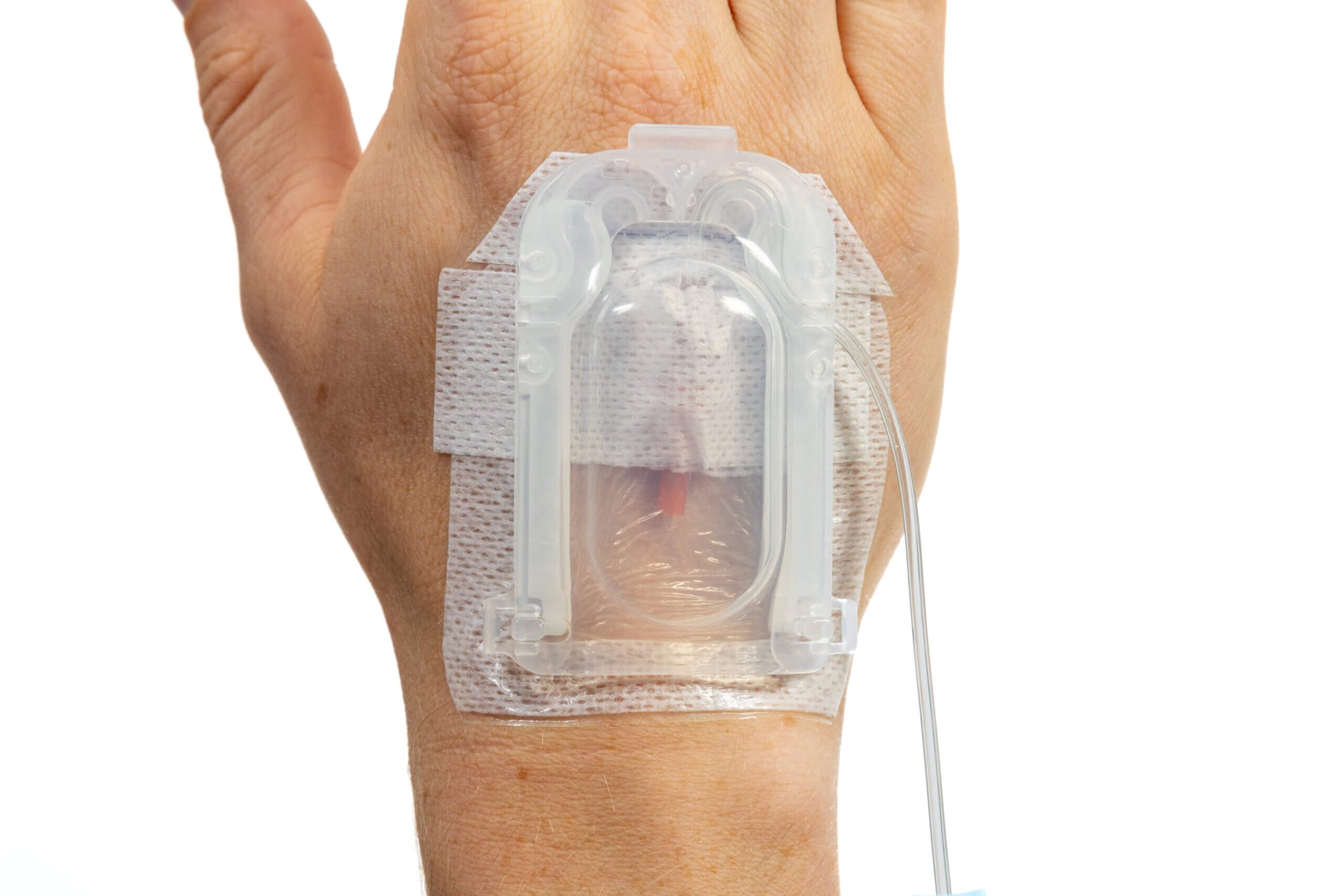 IV Glove 3.0 strapless IV securement gloves, pack of 25, showing sterile, flexible material for IV site stabilization.