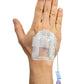 IV Glove 3.0 strapless IV securement device on open and closed hand, designed for secure catheter stabilization.