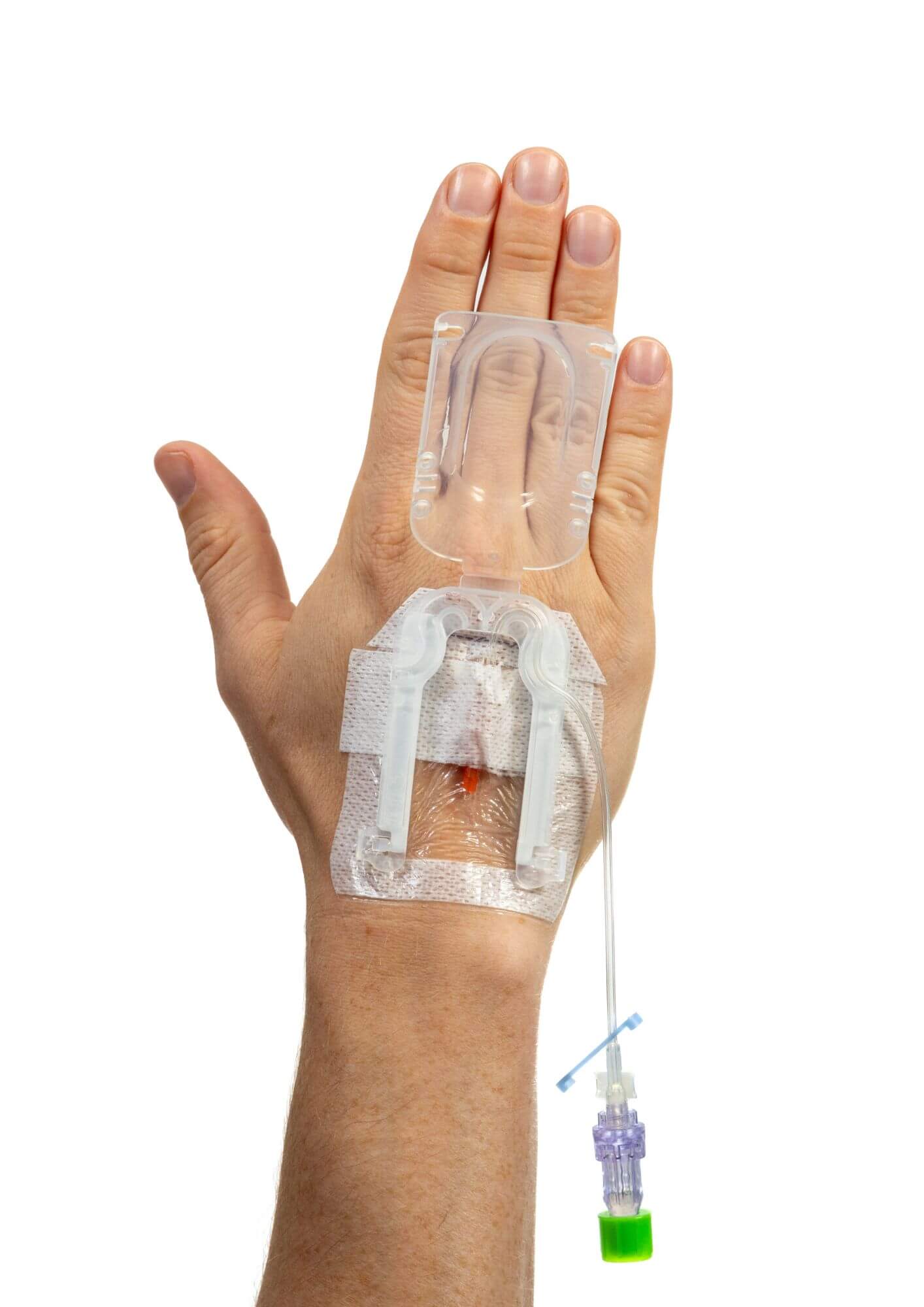 IV Glove 3.0 strapless IV securement device on open hand, designed for secure IV placement and easy application.