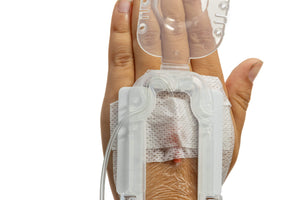 Open hand with IV Glove EasyStick IV securement device on the palm, showing strapless stability for pediatric IV management.