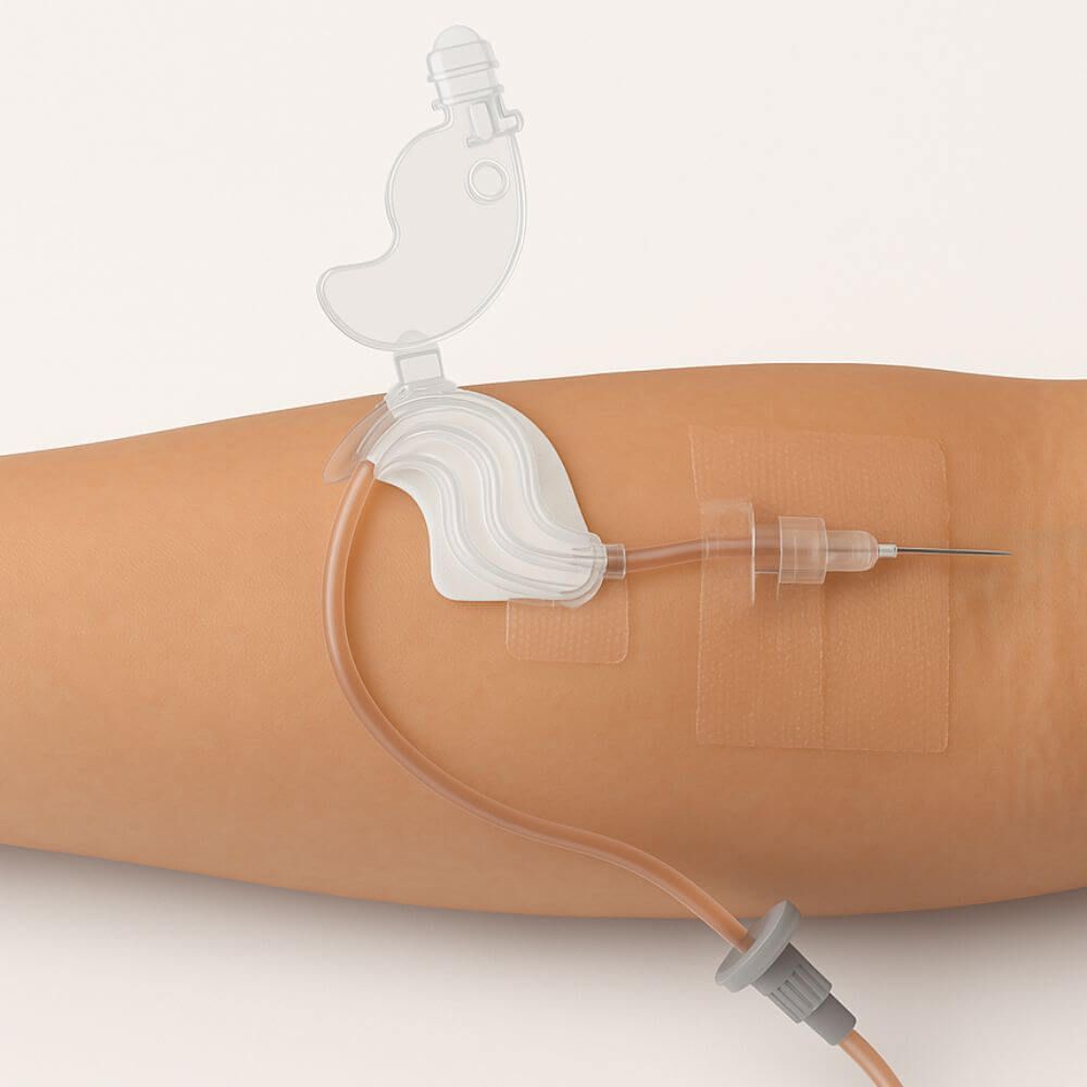 IVG Mini IV Securement Device used to secure peripheral cannulas, shown in a pack of 150, designed for medical IV procedures.
