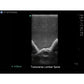 Blue Phantom spinal epidural model ultrasound image