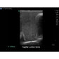 Blue Phantom spinal epidural model positioned for training