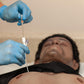 Russell PneumoFix®-8 Sterile Decompression Needle