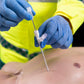 Russell PneumoFix Veress Tipped Needle - Long - 11cm