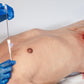 Russell PneumoFix Veress Tipped Needle - Long - 11cm