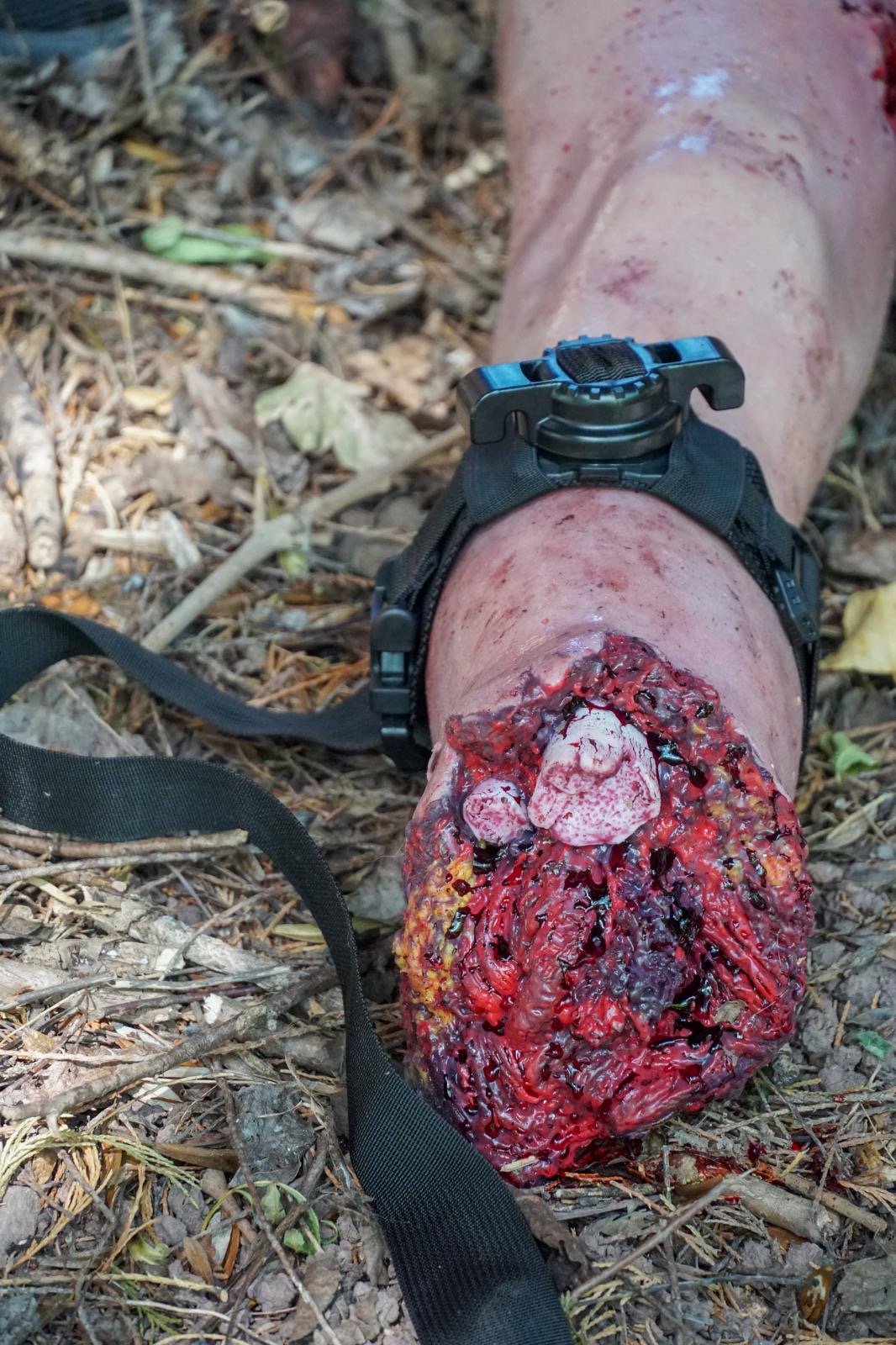 SimUniq Tourn-IQ Tourniquet & Wound Packing Trainer – Traumatic Amputation Limb